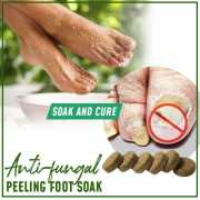 Anti-fungal Detox Foot Soak